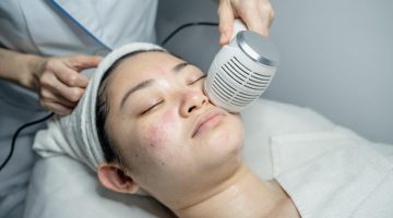 5 Skin Solution Treatments